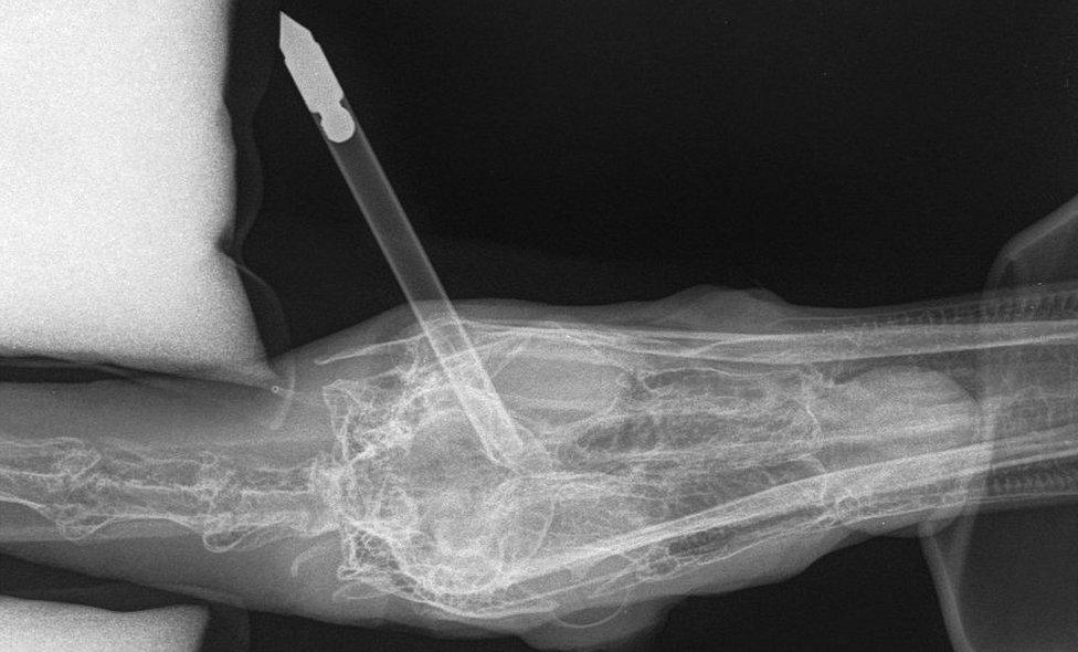 Injured swan