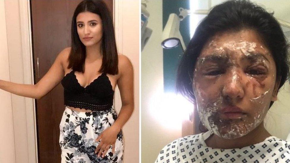 Images of Resham Khan before and after the acid attack