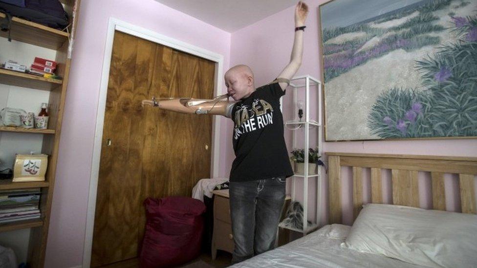 15-year-old Pendo Sengerema from Tanzania puts on her prosthetic arm in her bedroom in the Staten Island borough of New York, September 21, 2015