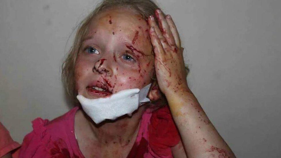 Picture of injured girl