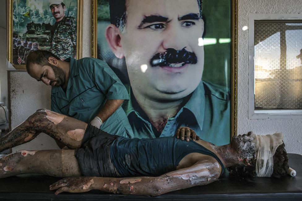 Mauricio Lima, Brazil, 2015 for The New York Times, IS Fighter Treated at