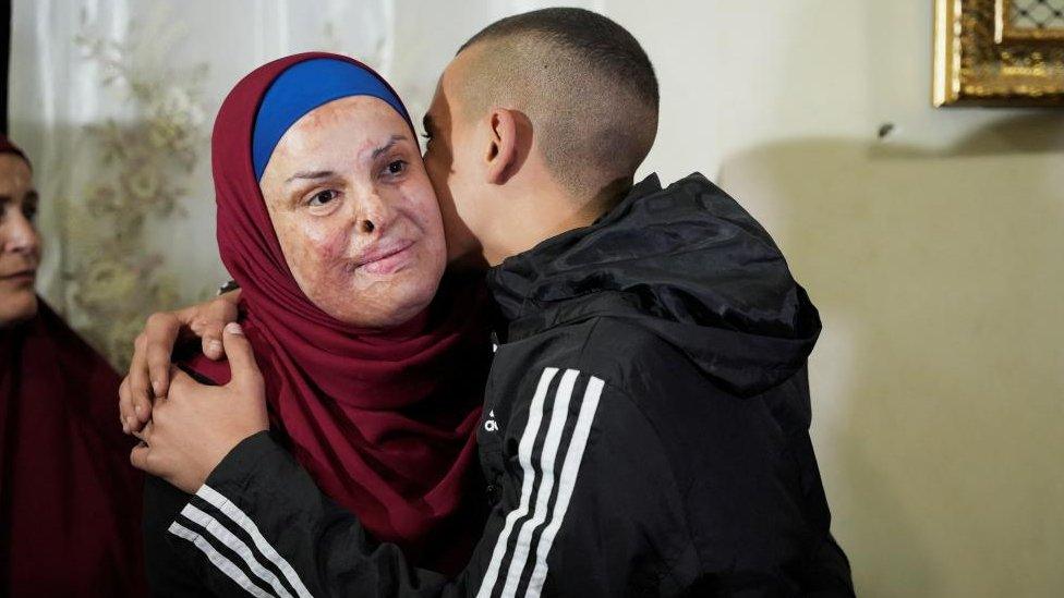 Israa Jaabis was among the second group of Palestinian detainees released by Israel