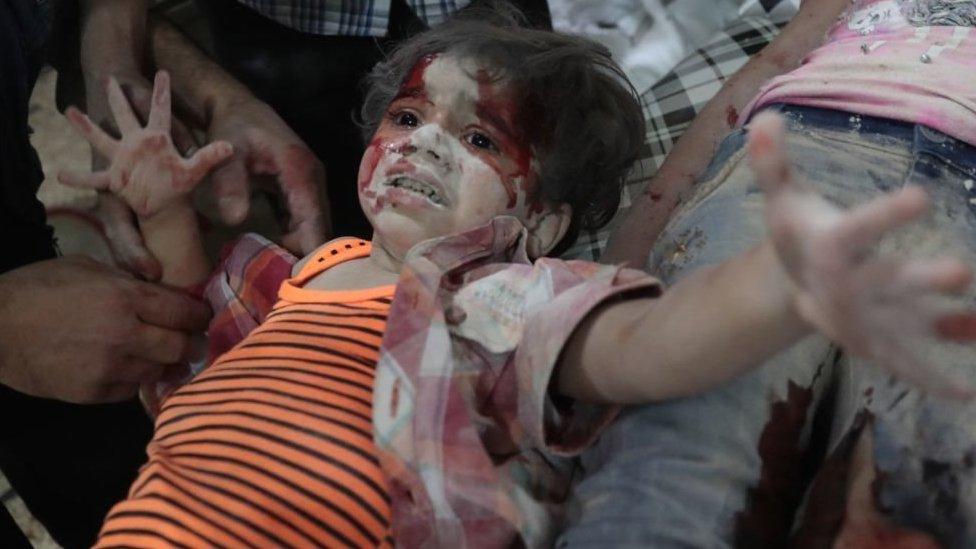 A Syrian girl crying out covered in dust and blood