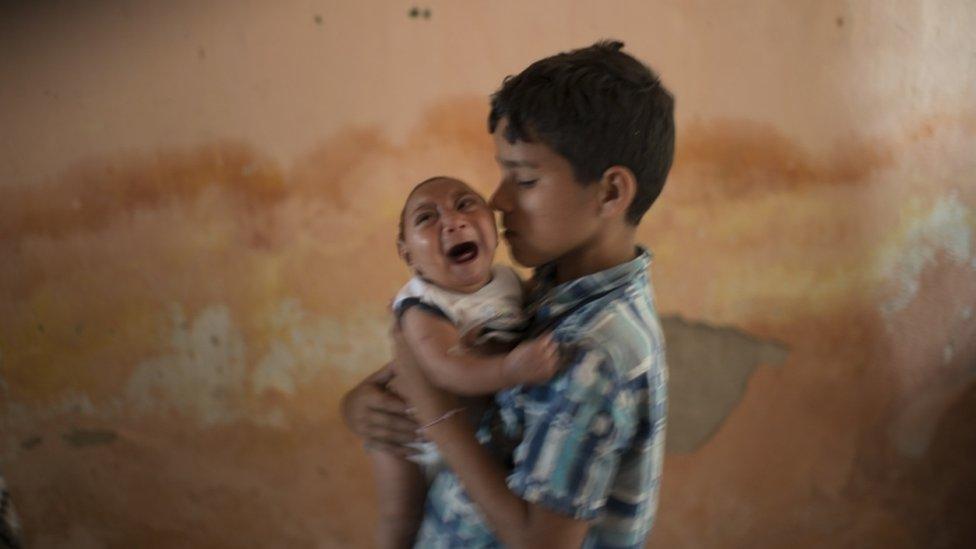 In this Dec. 23, 2015 photo, 10-year-old Elison nurses his two-month-old brother Jose Wesley at their house in Poco Fundo, Pernambuco state, Brazil born with microencephaly