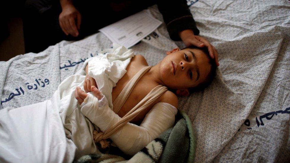 A Palestinian boy wounded at a protest on the Gaza-Israel border is treated at a hospital in Gaza City (1 April 2018)