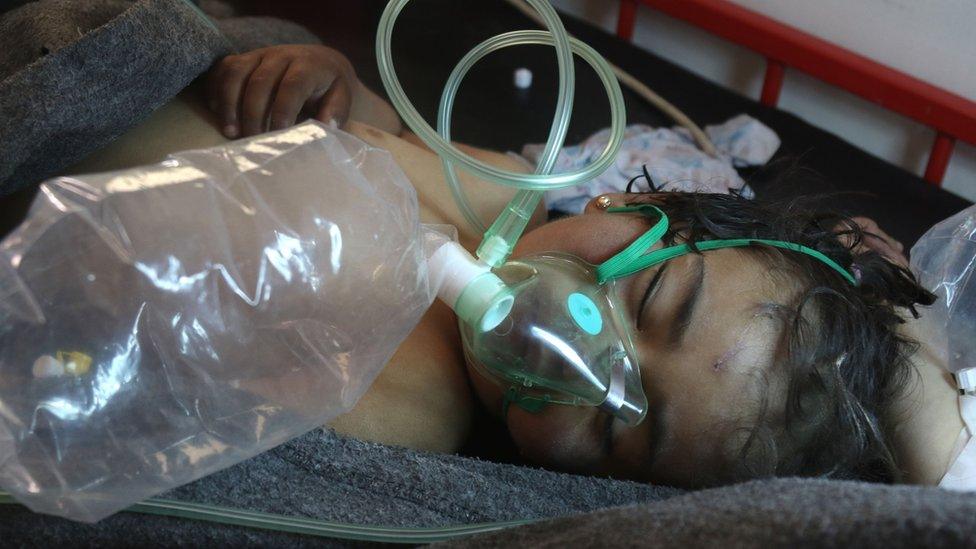 File photo taken on 4 April 2017 shows a Syrian child receiving treatment at a hospital in the town of Maarat al-Numan following a suspected Sarin attack in Khan Sheikhoun