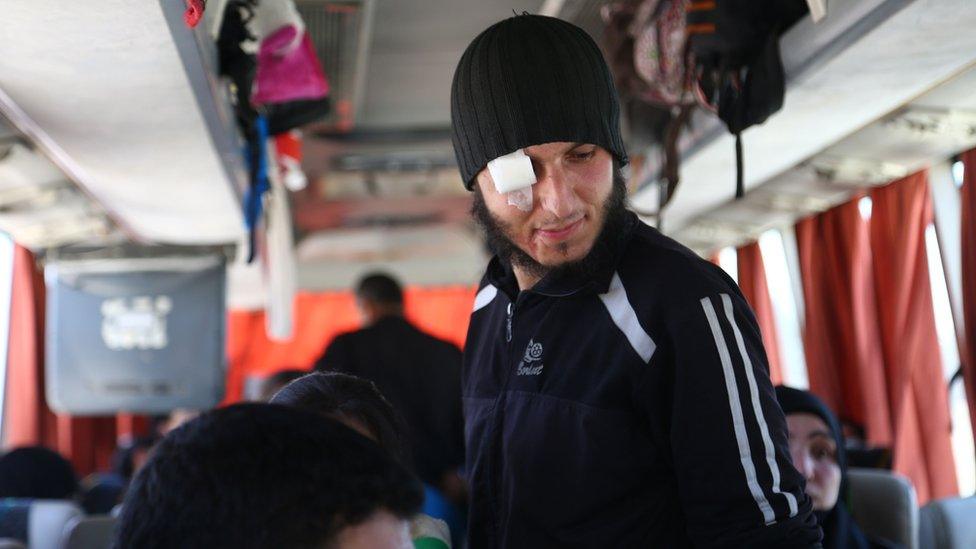 Injured Jaysh al-Islam fighter on board a bus travelling from Douma to northern Syria (5 April 2018)