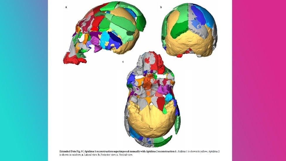 Apidima 1 reconstruction superimposed manually with Apidima 2 reconstruction