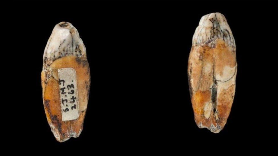 Neanderthal teeth