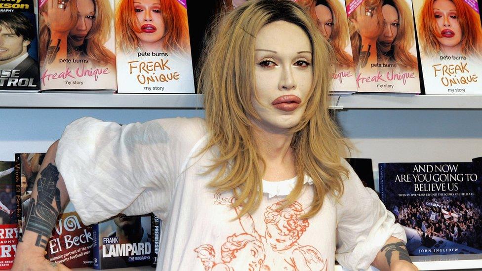 Pete Burns autobiography