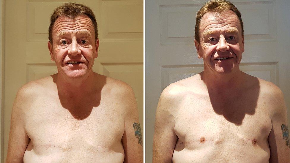 Peter, before and after having nipple tattoos