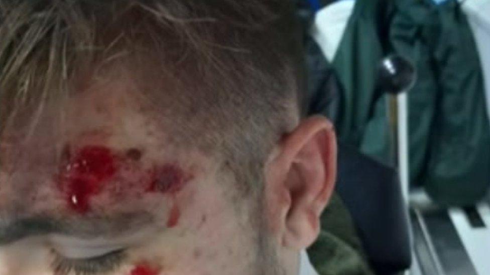 James Rawlings' head injuries