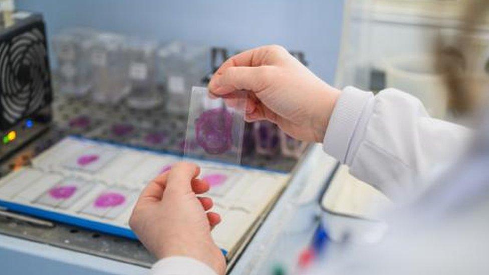 cells being examined in a lab