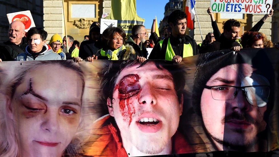 Demonstrators hold a banner showing bruised faces of gilets jaunes (yellow vests) protesters in Montpellier, southern France, 12 January 2020