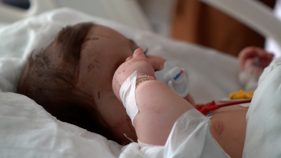 A six-month-old girl in Adana hospital