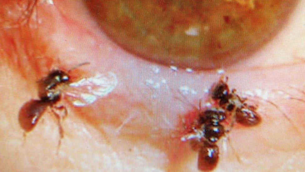 Three sweat bees near a woman's eye