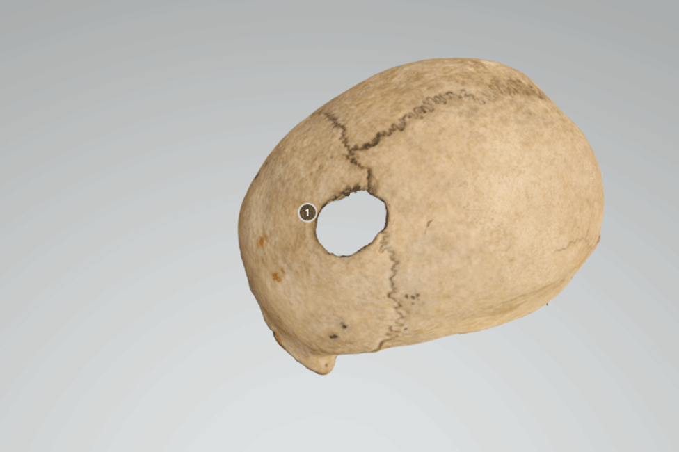 3D digital model of skull