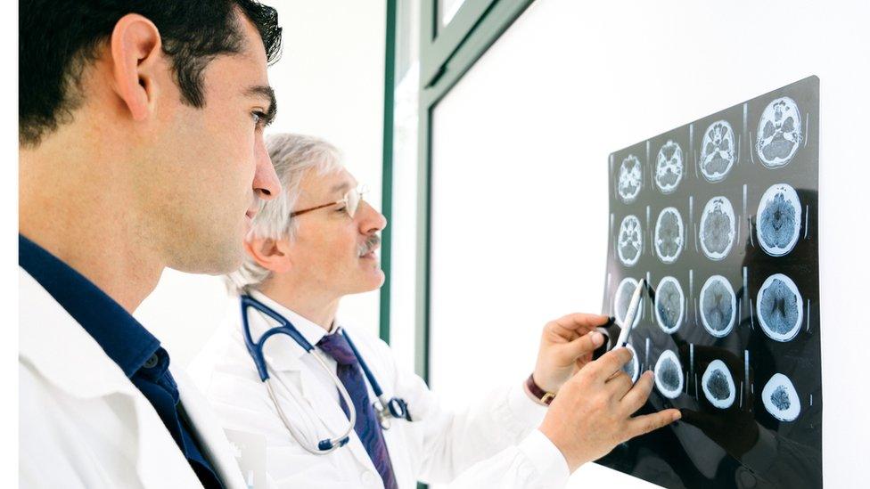 Doctors looking at a series of brain scans