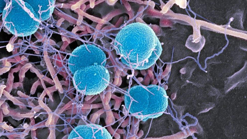 meningitis bacteria