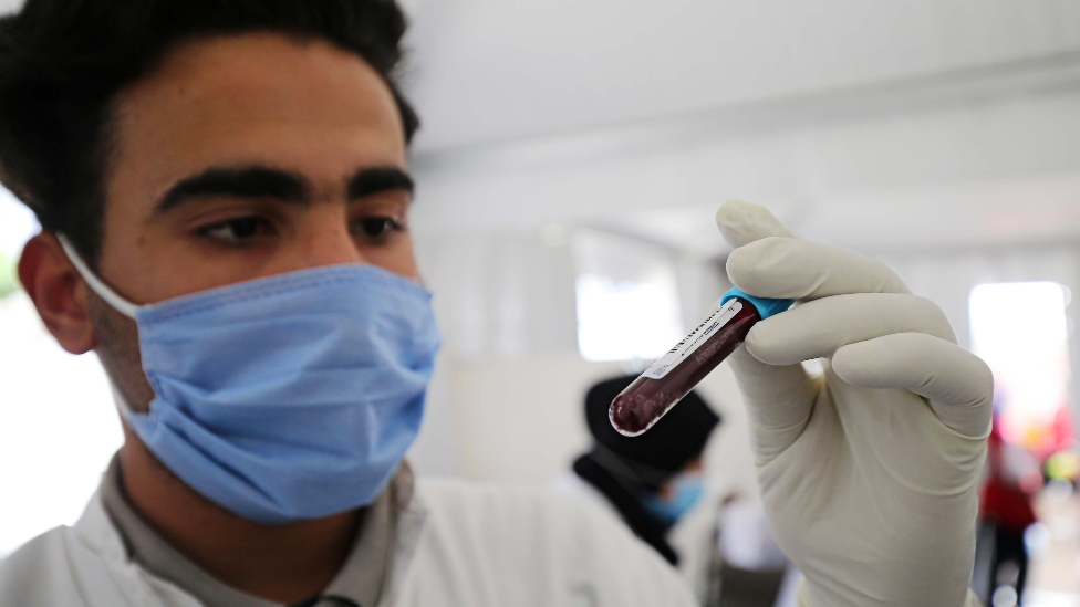 A doctor with a vial of blood in Algiers - June 2020