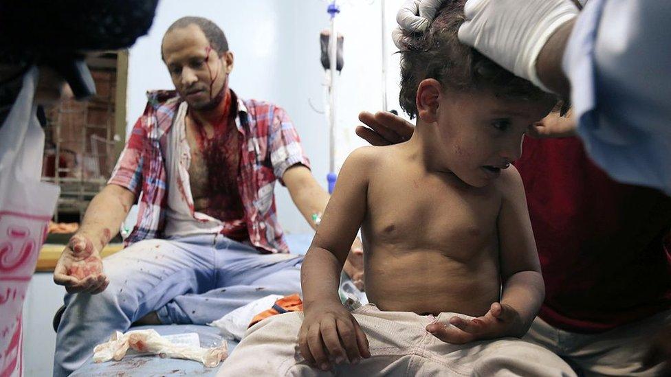 A Yemeni boy receives treatment at a hospital after being injured in fighting in Taiz (21 September 2015)