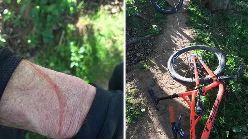 Injured man in woods with wire strung over pathway