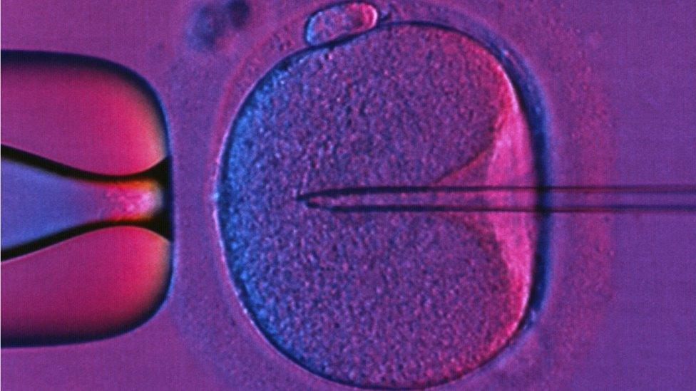 In Vitro Fertilization