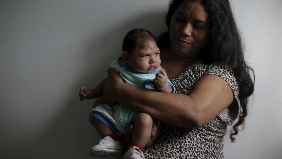 A mother and baby - with microcephaly - in Brazil