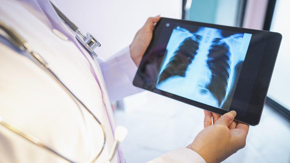 Doctor explaining results of lung check up from x-ray scan (stock photo)