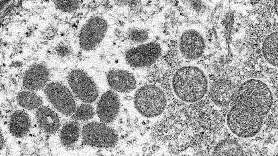 Monkeypox virus under a microscope