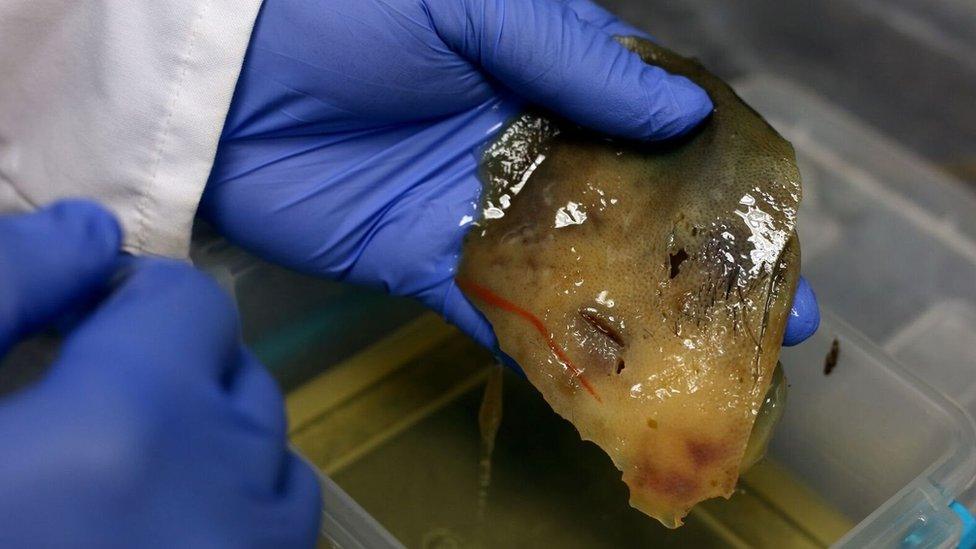 Dr Alejandro Hernández Cárdenas holds a piece of skin with a tattoo