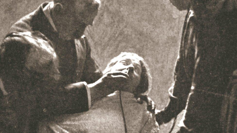 Suffragette being force fed with the nasal tube in Holloway Prison, London, 1909