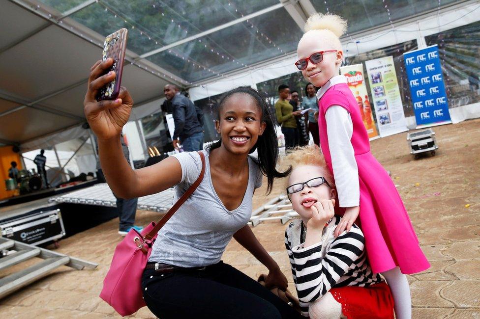 Participants are seen backstage at Mr and Miss Albinism beauty pageant