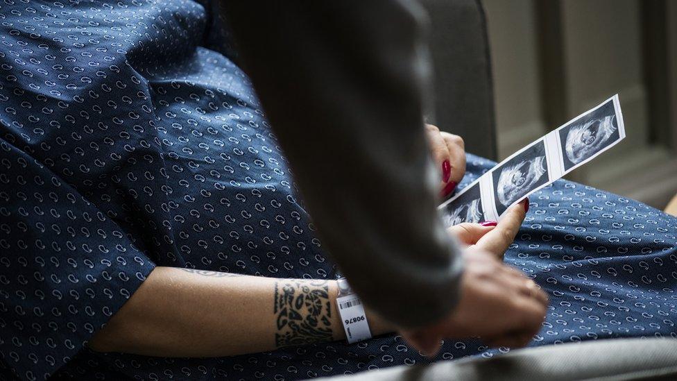 A pregnant woman holding a baby scan