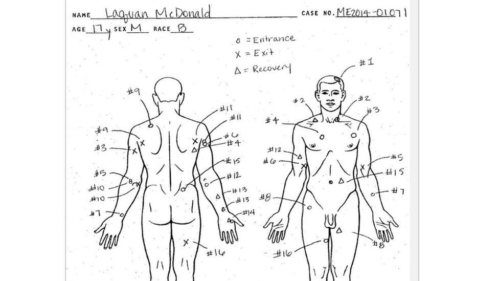 A diagram from McDonald's autopsy