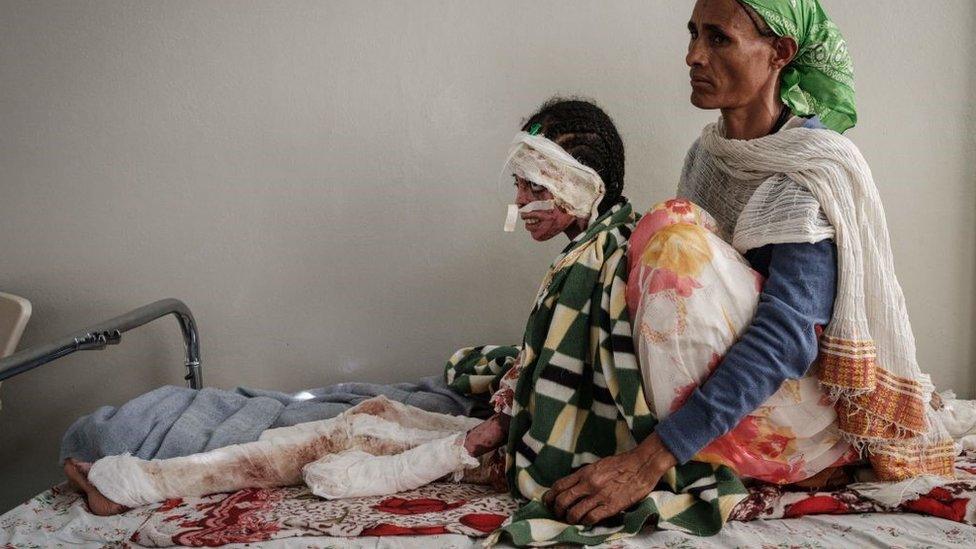 Kisanet Gebremikael (L), 13, is supported by her mother Genet Asmelash, 40, at Ayder Referral Hospital in Mekele, the capital of Tigray region, Ethiopia, on June 21, 2021.