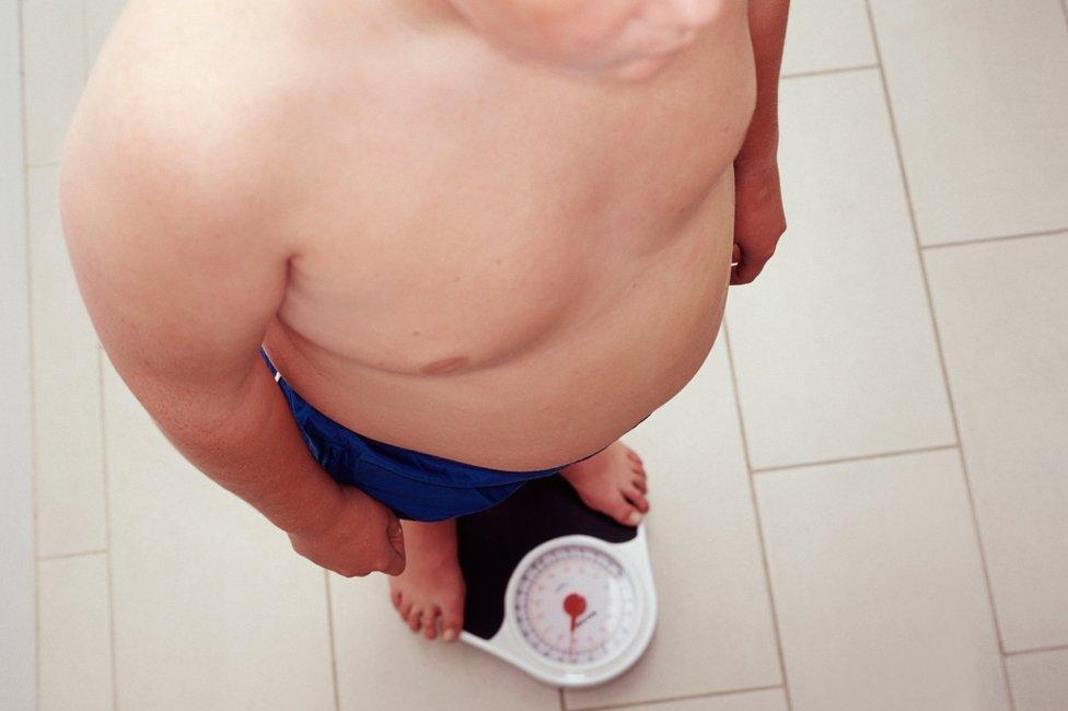 An overweight child stands on scales