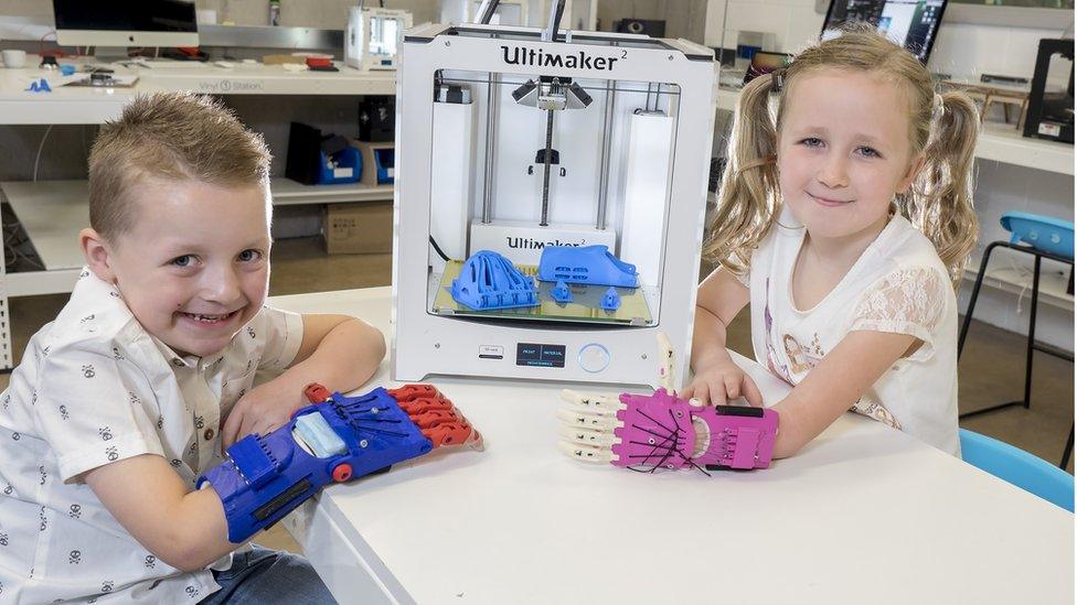 Cian and Emilie showing off their prosthetic hands