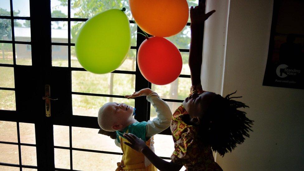 An albino girl plays with balloons, on Ukerewe island in Tanzania - Monday 13 June 2016