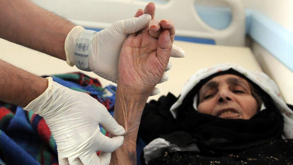 A woman suspected of being infected with cholera receives treatment at a hospital in Sanaa, Yemen (6 June 2017)