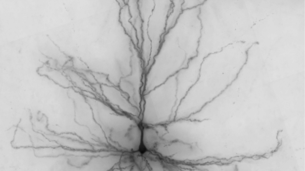 Human brain cell