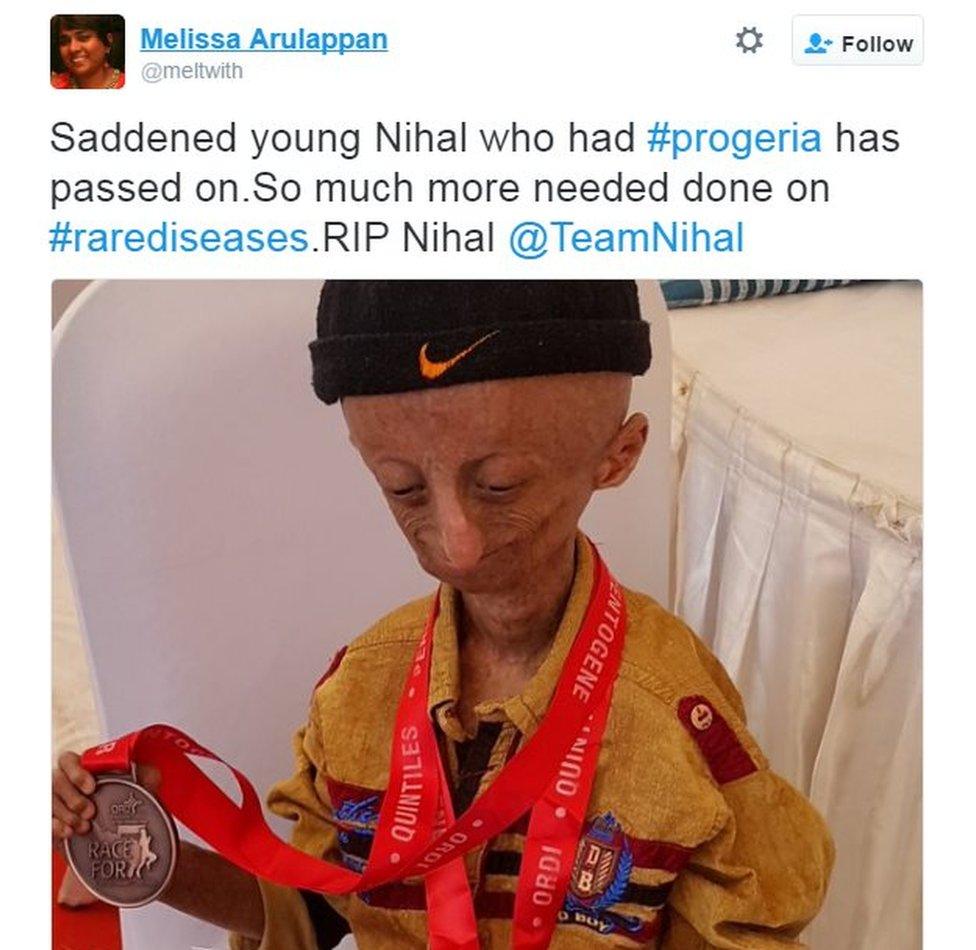 Saddened young Nihal who had #progeria has passed on.So much more needed done on #rarediseases.RIP Nihal @TeamNihal