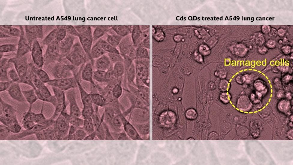 Lung cancer cells - treated and untreated