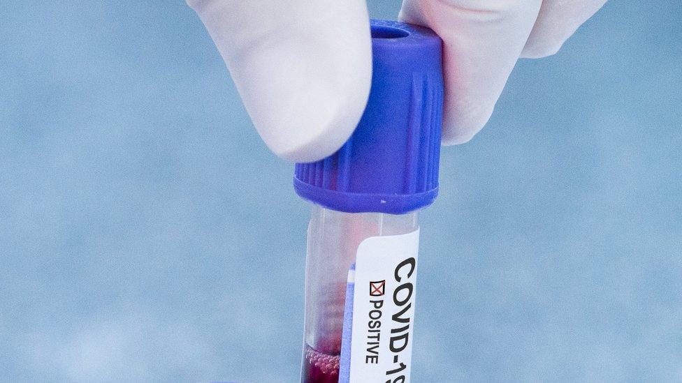 Hands of a laboratory worker holding positive test tube for COVID-19 coronavirus