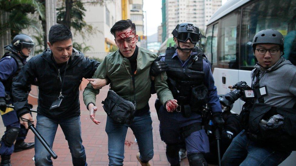 Injured man being led away by police