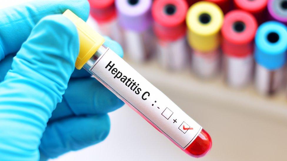 Blood test for Hepatitis C