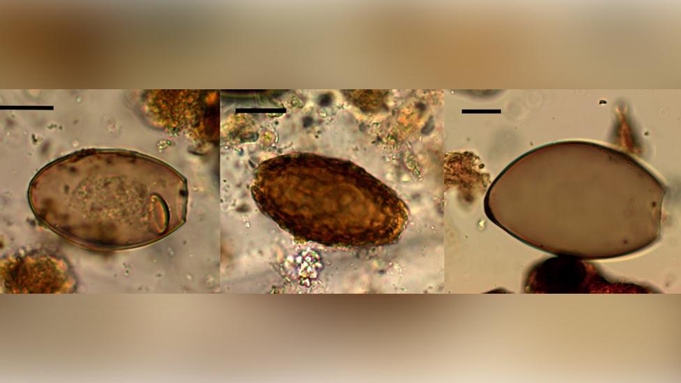 Microscopic eggs of fish tapeworm (left), giant kidney worm (centre) and Echinostoma worm (right) from Must Farm