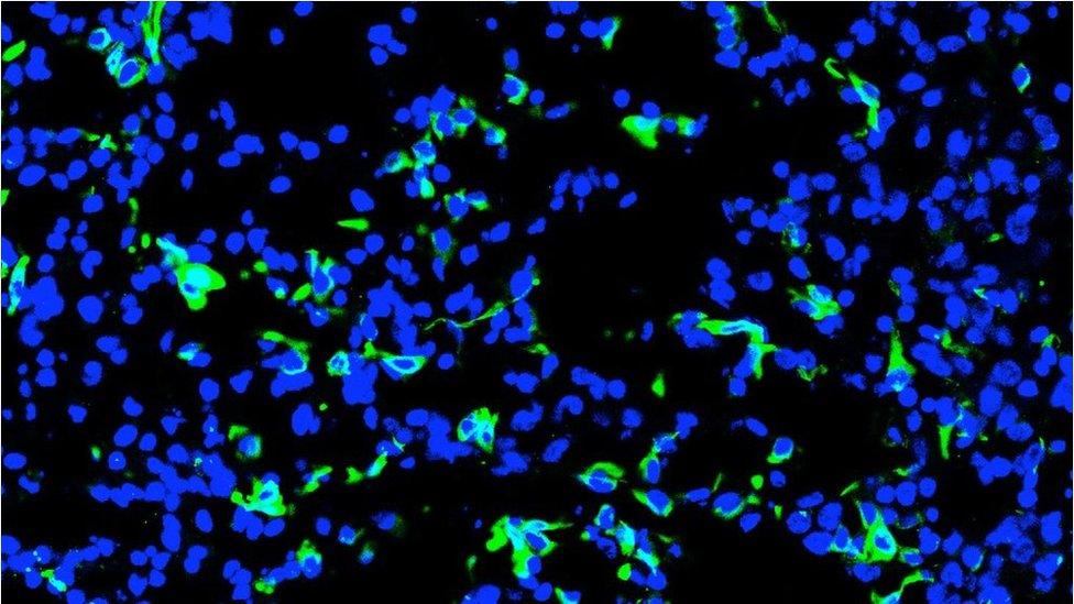 Human and pig cells