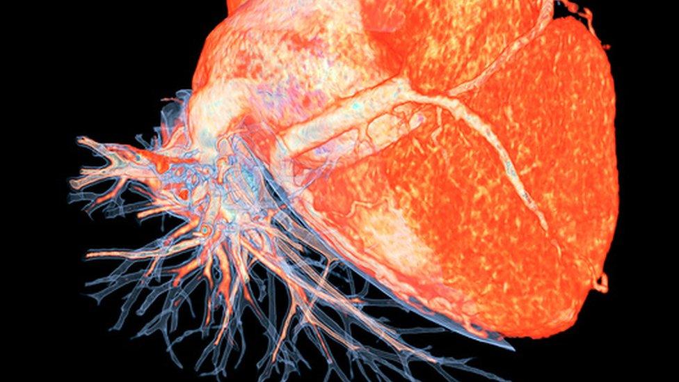 A 3D scan of the heart