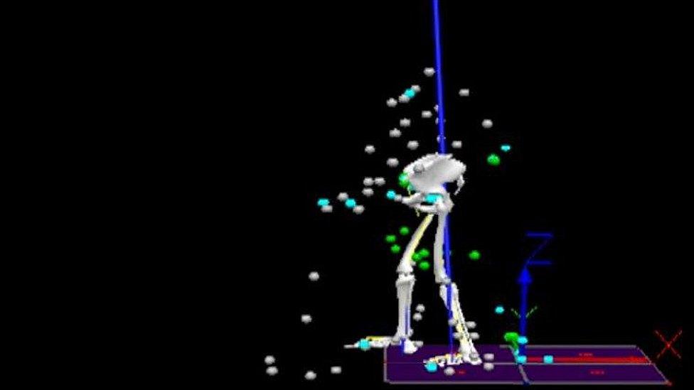 CGI shots of stroke patient